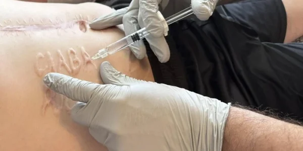 Лікарі допоможуть військовому позбутися зробленого росіянами страшного напису на тілі