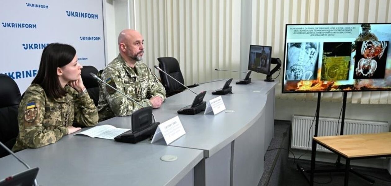 Вже не кулі: головний хірург ЗСУ розповів, що найбільше травмує бійців